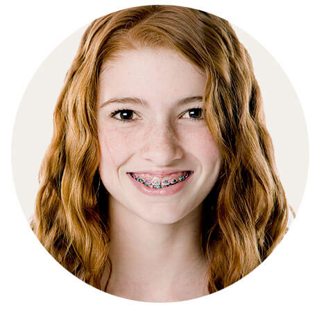 sideimage-braces sideimage-braces