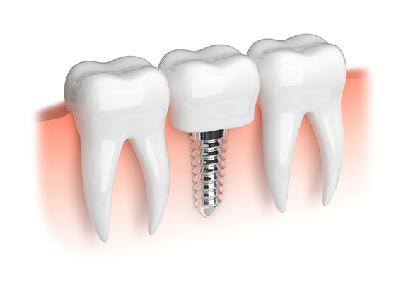 sideimage-dental sideimage-dental