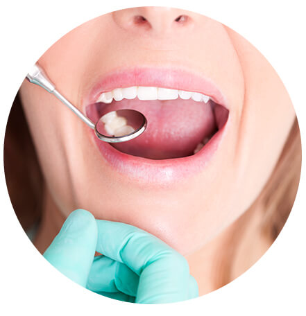 sideimage-dentalexam sideimage-dentalexam