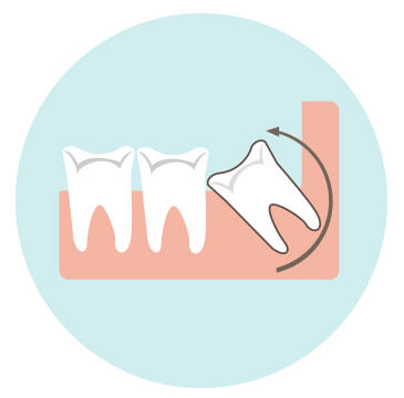 sideimage-extraction sideimage-extraction